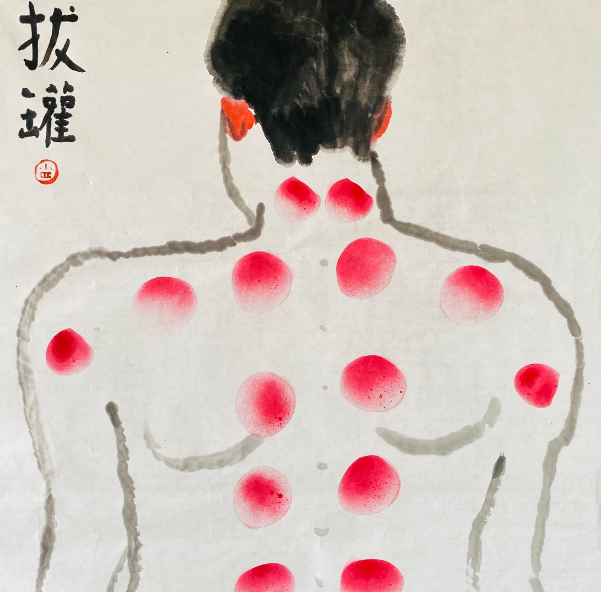 4. 「熱暑人－熱／暑的文化與當代藝術」展出作品：蔡宗祐，《拔罐圖》，2023，水墨、噴漆、水性顏料，70x69 cm，藝術家自藏。（圖片來源：藝術家提供）